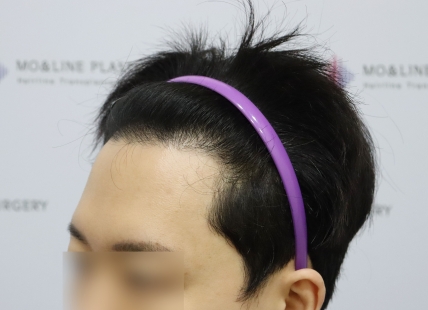 치료후기 이미지
